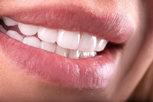 Myths About Cosmetic Dentistry