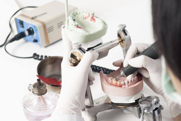 Reasons To Consider CEREC Same Day Crowns