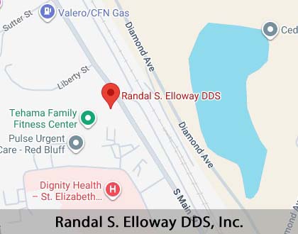 Map image for What to Expect When Getting Dentures in Red Bluff, CA