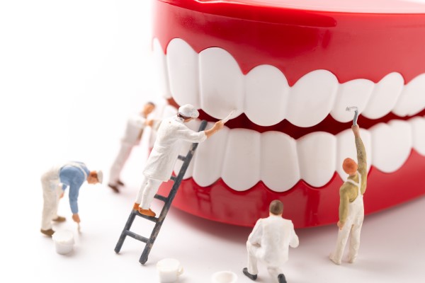 Implant Supported Dentures: Should You Try Denture Repair First?