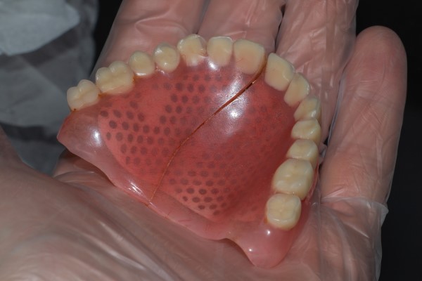 How To Extend The Life Of Your Dentures With Denture Repair