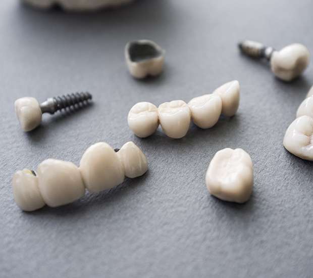 Red Bluff The Difference Between Dental Implants and Mini Dental Implants