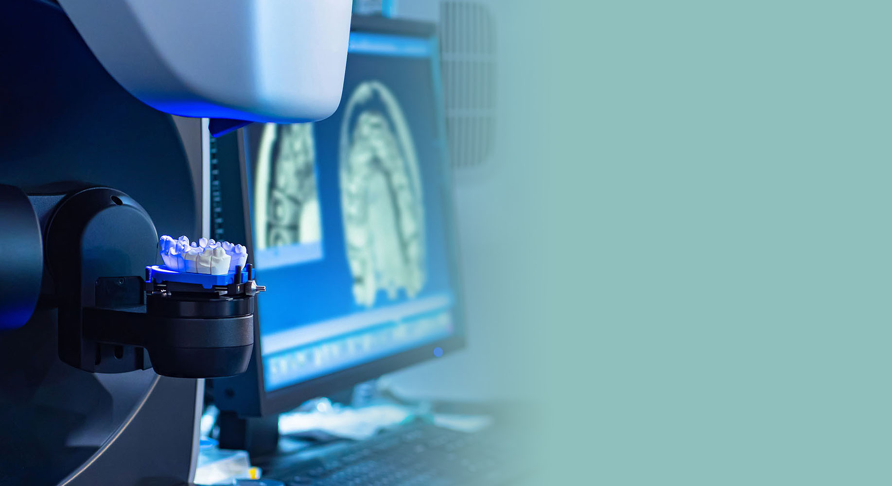 CEREC® - The Latest in Dental Technology