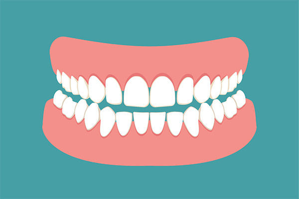 The FAQ’s of Denture Care from Randal S. Elloway DDS, Inc in Red Bluff, CA