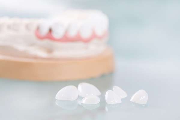 How Many Dental Veneers Do I Need?